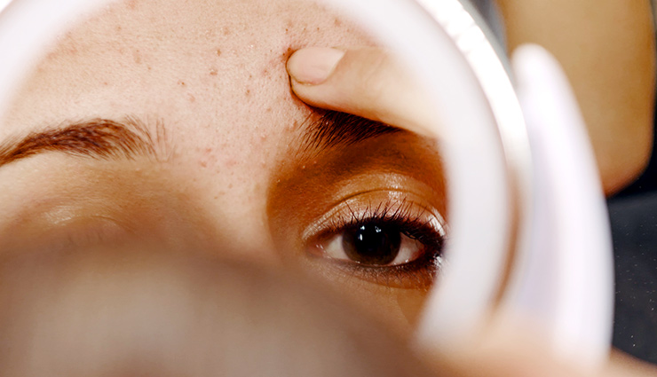 روش‌های کاربردی برای جلوگیری از بروز جوش‌های صورت