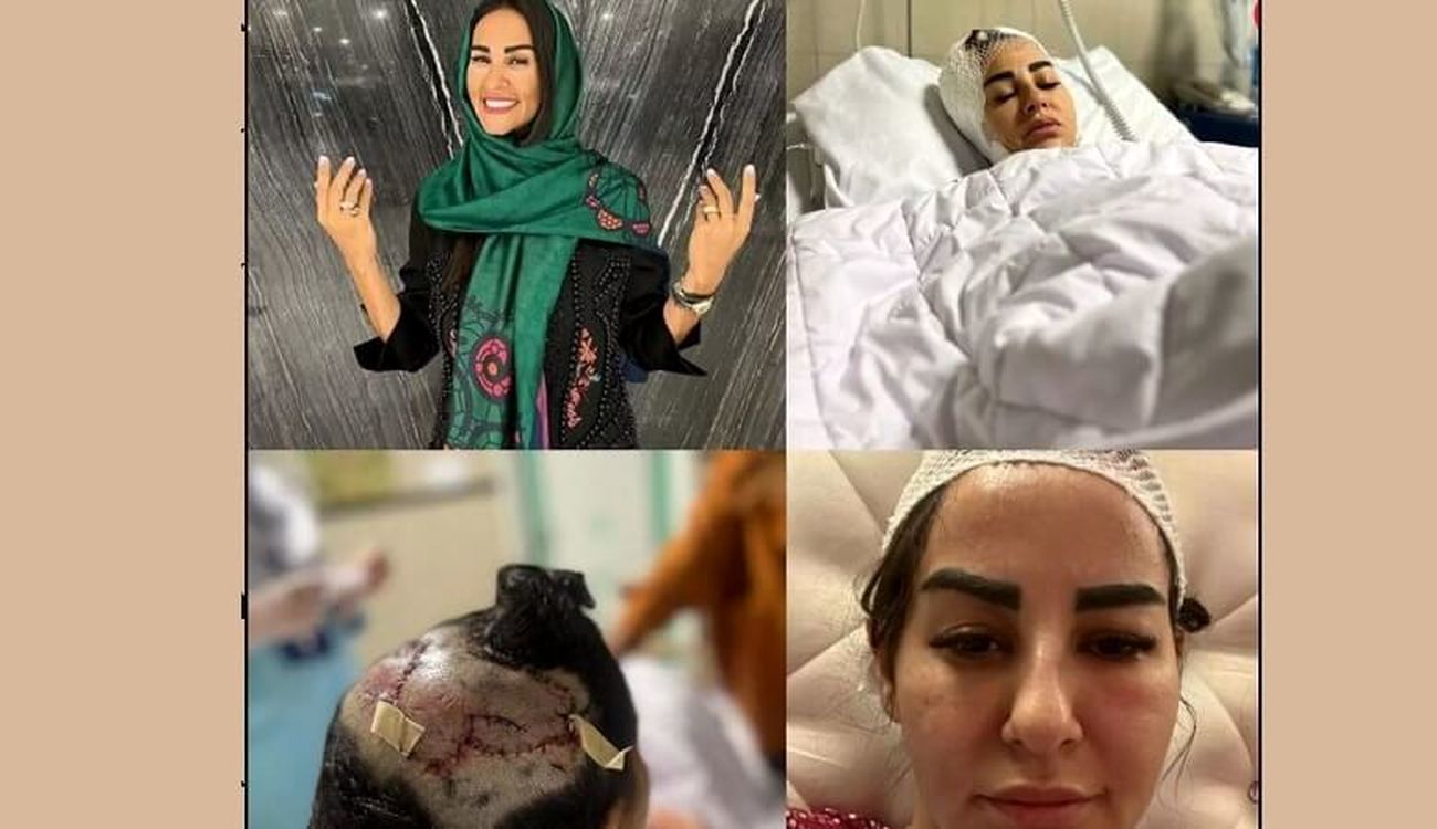 بانوی تهرانی پس از حمله سگ به قتل تهدید شد، جزئیات این حادثه ترسناک