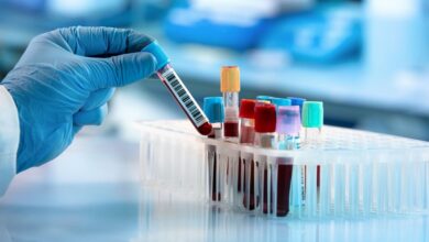انواع آزمایشات قابل انجام در آزمایشگاه خون